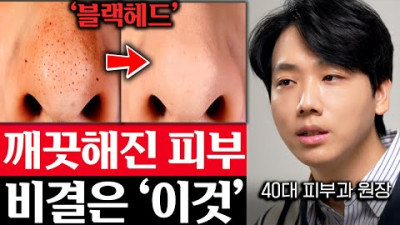 <물리적 자극 절대 불가 역효과, 해결방법은 바세린, 클렌징오일, 기타 오일> 깔끔하게 사라집니다. 꽉 막힌 모공 청소하고 블랙헤드 제일 '빨리' 제거하는 방법