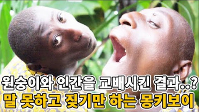 원숭이와 인간이 낳은..? 24살 말 못하고 짖기만 하는 원숭이 소년