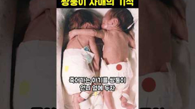 죽어가는 아기를 쌍둥이 언니 옆에 두자 기적이 일어나는데...